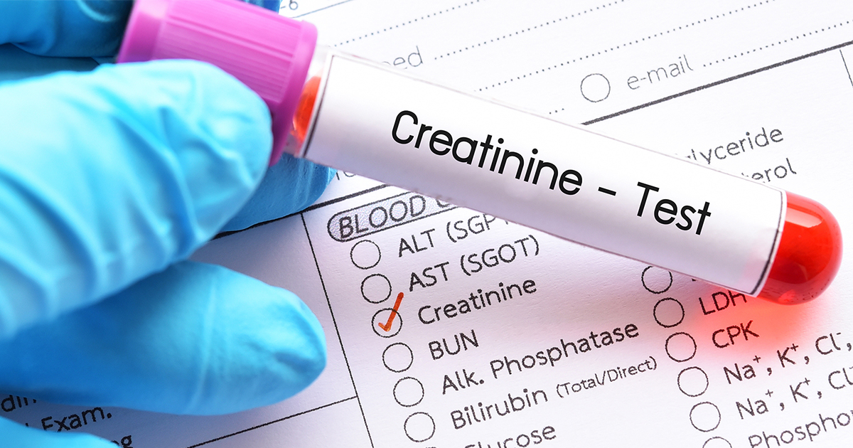 Understanding creatinine and kidney function