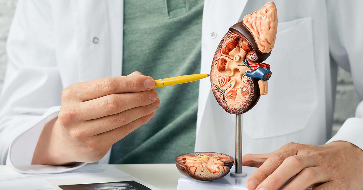 The Threat of Kidney Stones to Kidney Health and Function