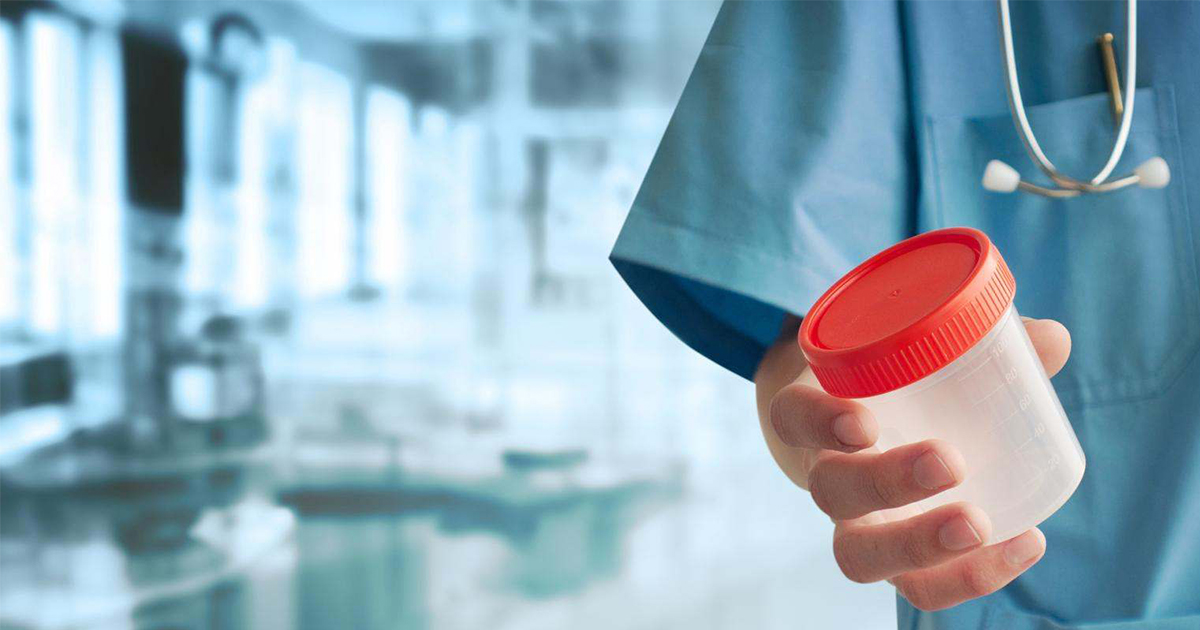 From Fear to Action: Conquering Apprehensions about Kidney Screening