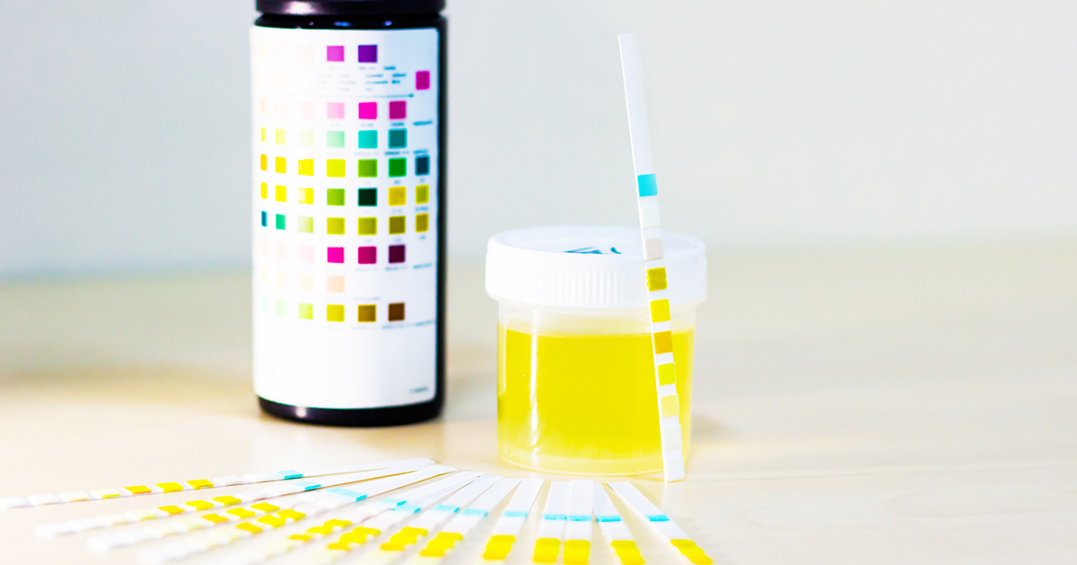 What Does eGFR level Stand For?