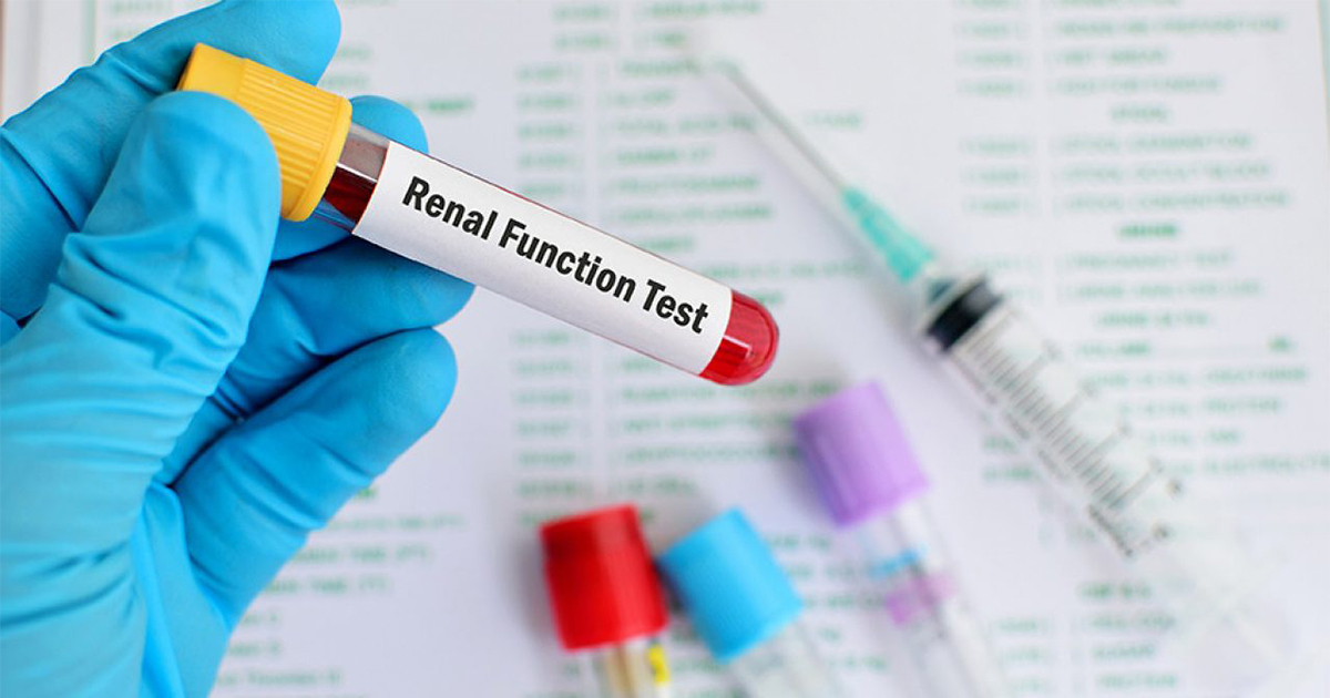 Your Guide to Kidney Health: Cracking the Code on Function Tests!