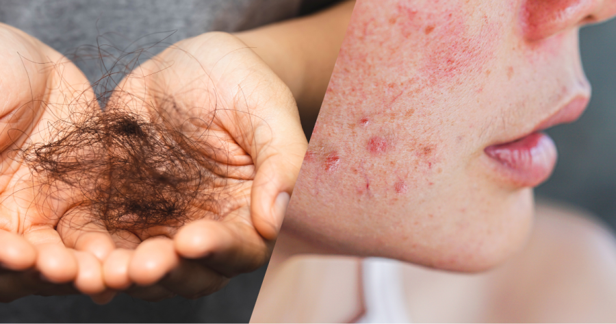 Balance Your Hormones by Caring Your Liver and Kidneys!