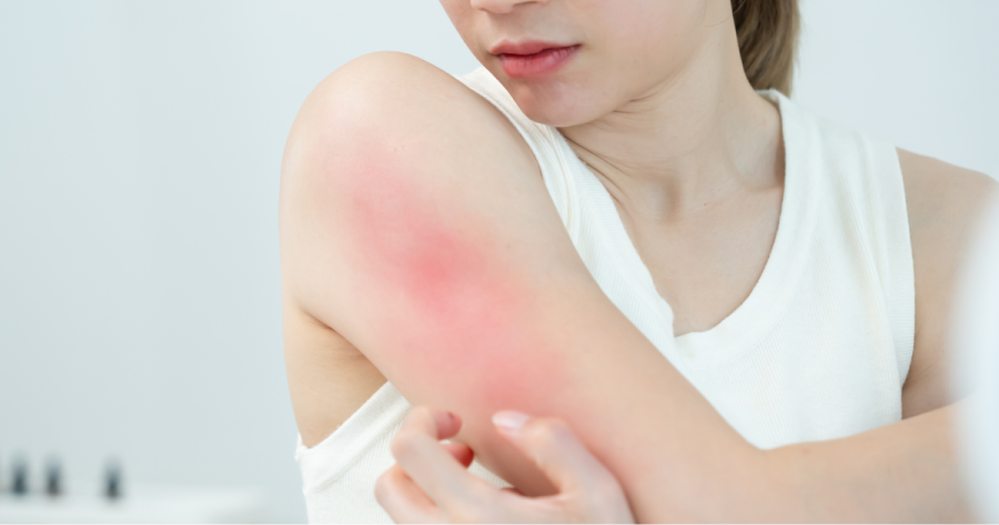 Unstoppable Itchy Skin Might Mean Kidney Trouble