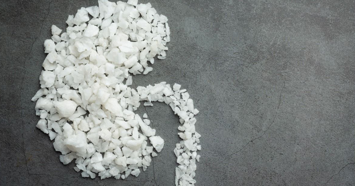 Key Minerals To Reduce Kidney Stones Recurrent