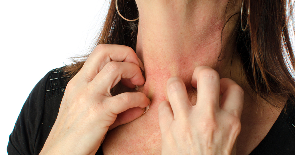 Poor Kidney Poor Skin